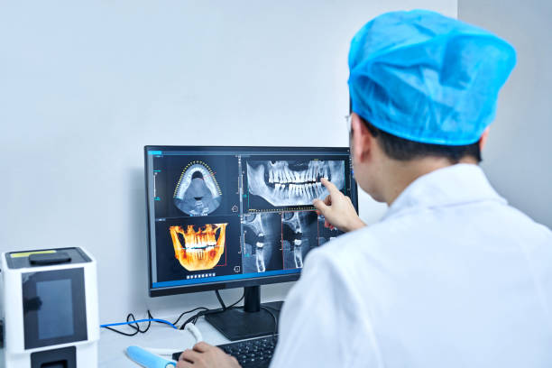 Best Emergency Wisdom Teeth Removal in Plantation, FL